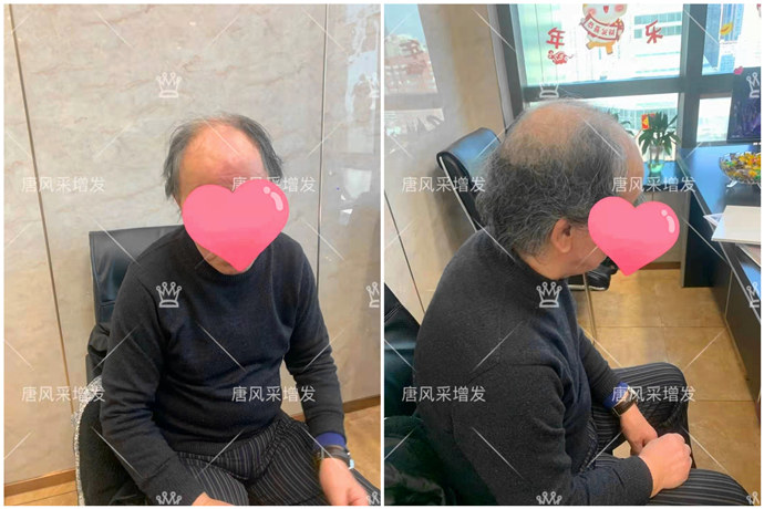 隱形增發(fā) \