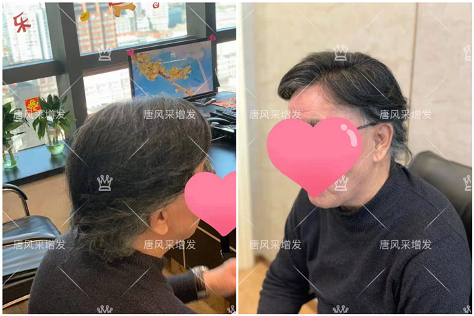 隱形增發(fā) \