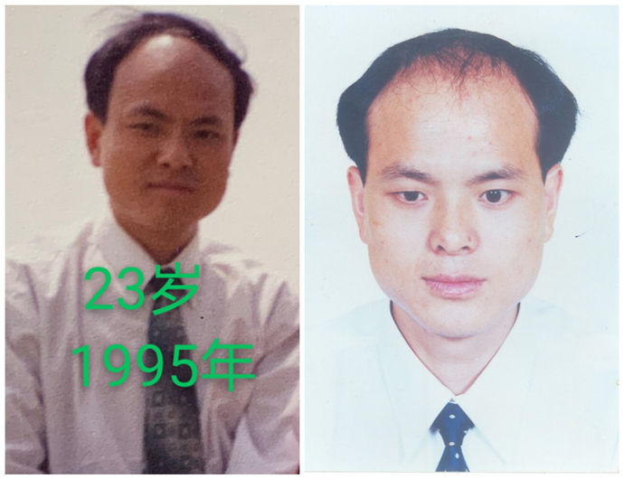 禿頂危機 \