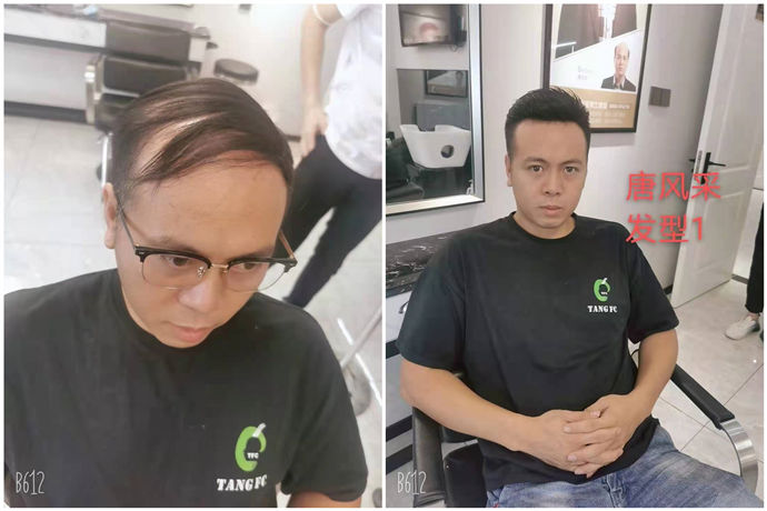 禿頂危機 \