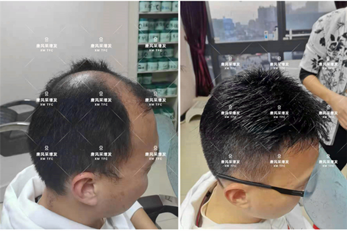 男式假發(fā)的價(jià)格及圖片 \