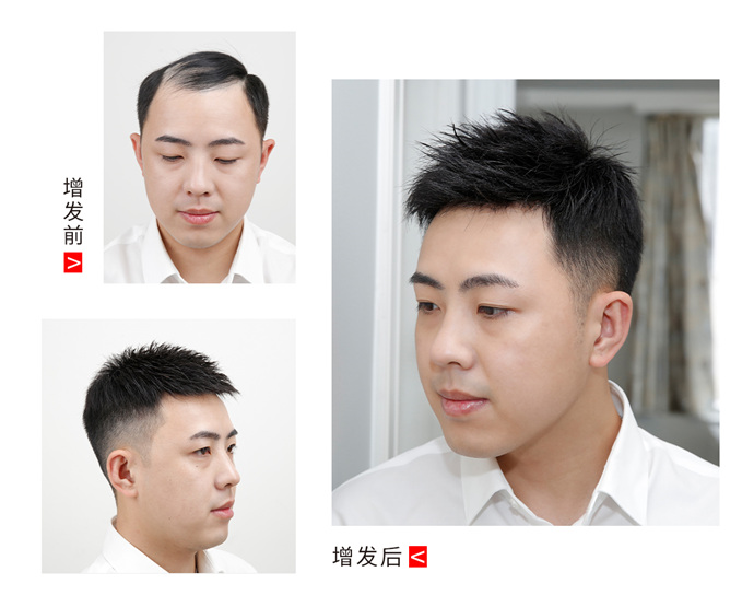 補(bǔ)發(fā)前補(bǔ)發(fā)后 \
