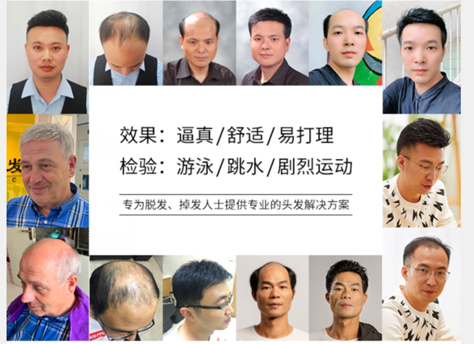 補(bǔ)發(fā)前補(bǔ)發(fā)后 \
