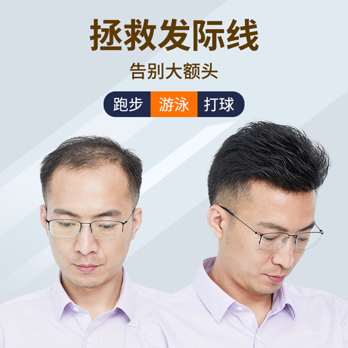 補(bǔ)發(fā)前補(bǔ)發(fā)后 \