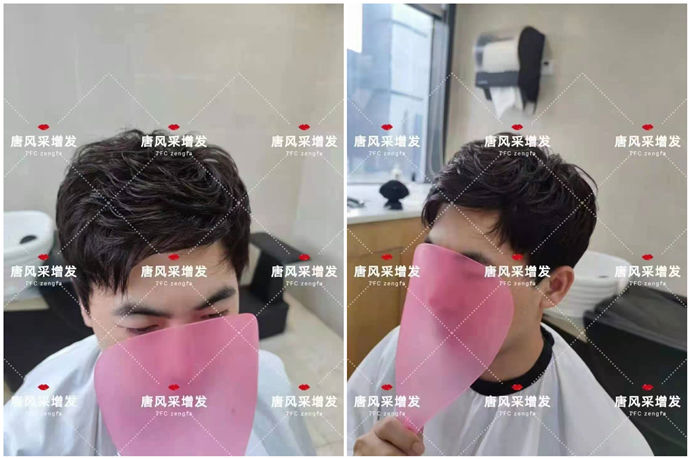 隱形男士假發(fā) \