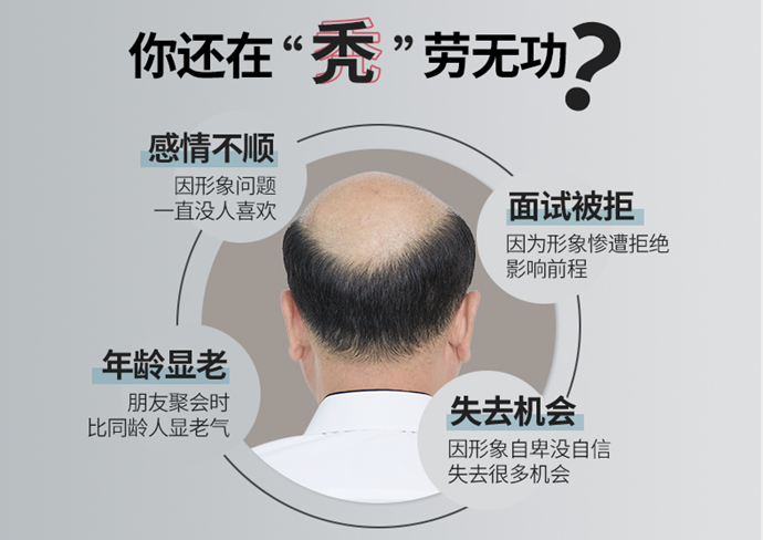 男士頭頂補發(fā) \
