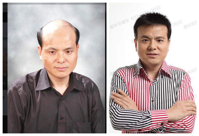 男士假發(fā)可以用多久 \