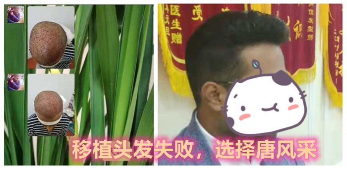 唐風(fēng)采隱形補(bǔ)發(fā) \
