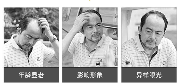 唐風(fēng)采隱形補(bǔ)發(fā) \