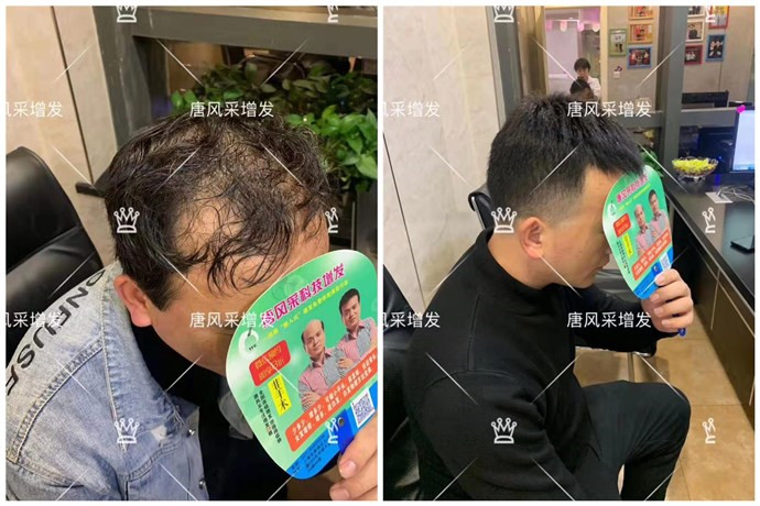 國內(nèi)假發(fā)什么牌子最 \
