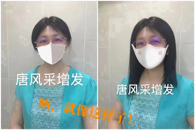 隱形無(wú)痕增發(fā) \