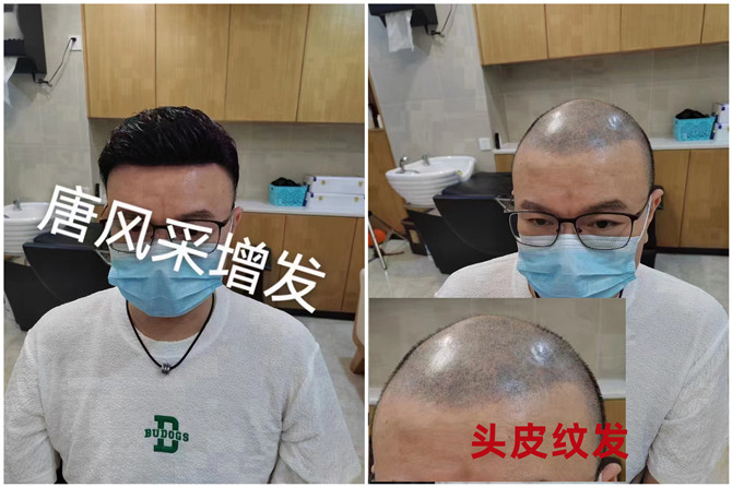 隱形增發(fā)效果 \