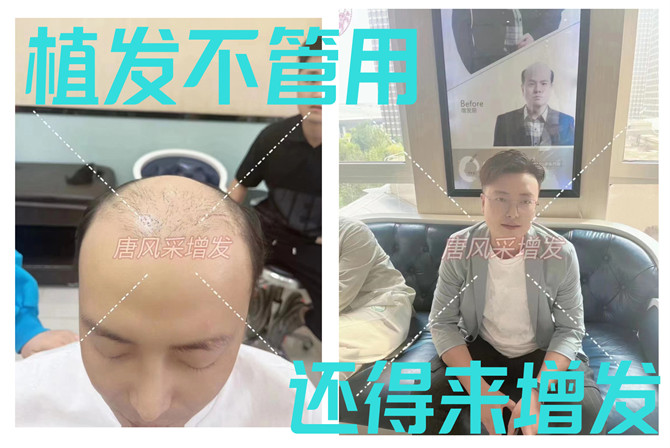 隱形增發(fā)效果 \