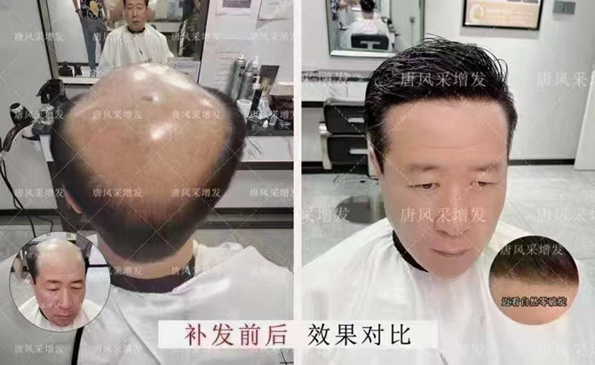 隱形增發(fā)效果 \