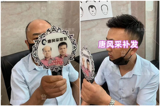 男士隱形補(bǔ)發(fā) \