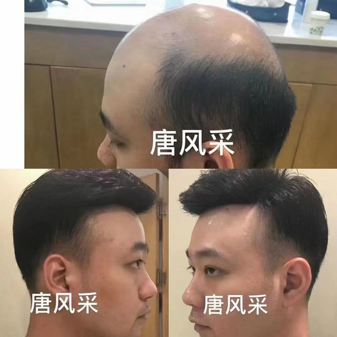 假發(fā)定做實(shí)體店 \