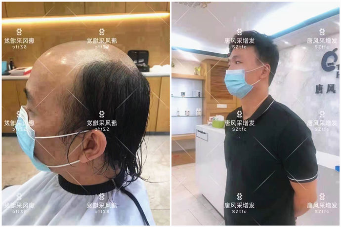 仿真男士補(bǔ)發(fā) \