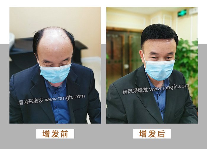 300塊的假發(fā) \