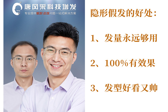 假發(fā)片怎么買 \