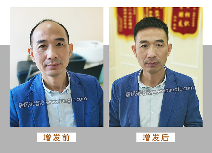 男人戴假發(fā)能看出來(lái)嗎 \