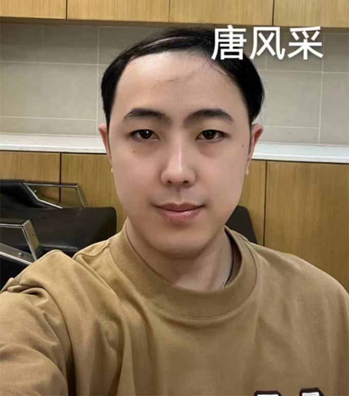 隱形補(bǔ)發(fā) \