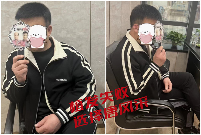 禿發(fā)男人 \