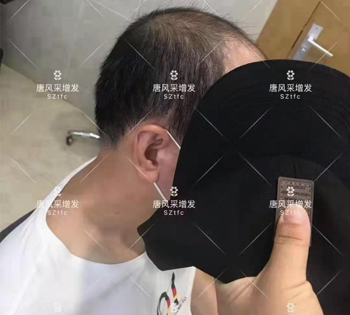 唐風(fēng)采做頭發(fā) \