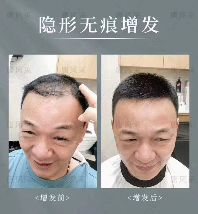 北京朝陽(yáng)哪里有賣假發(fā)的 \