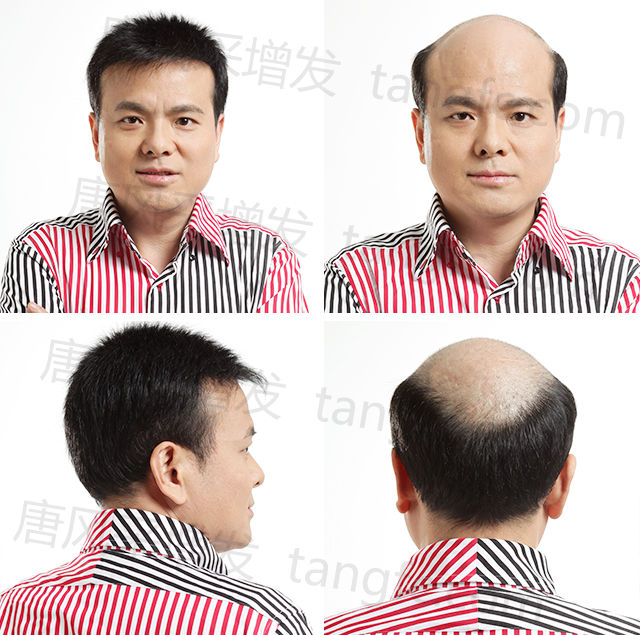 北京朝陽(yáng)哪里有賣假發(fā)的 \