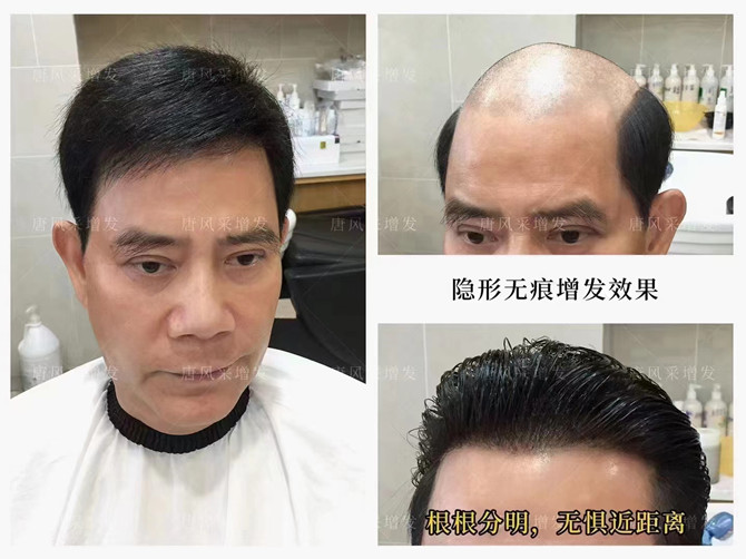 北京朝陽(yáng)哪里有賣假發(fā)的 \