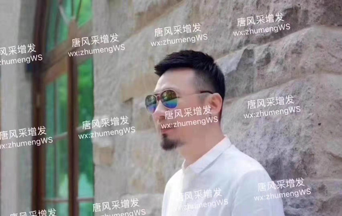 謝頂脫發(fā) \