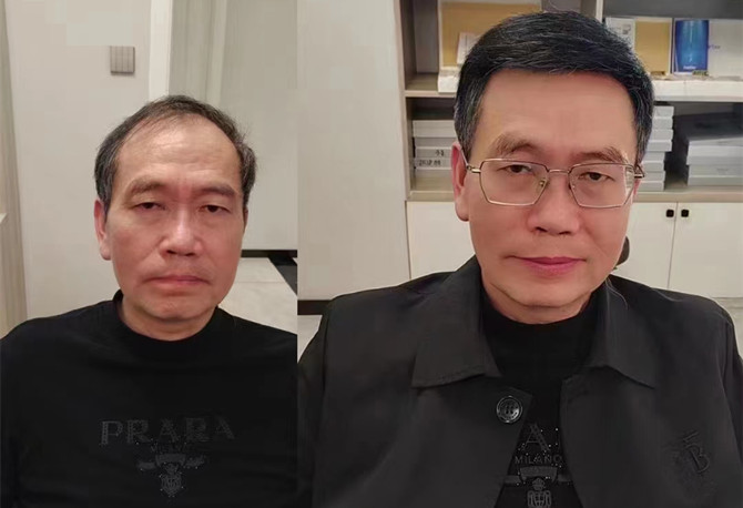 隱形增發(fā) \