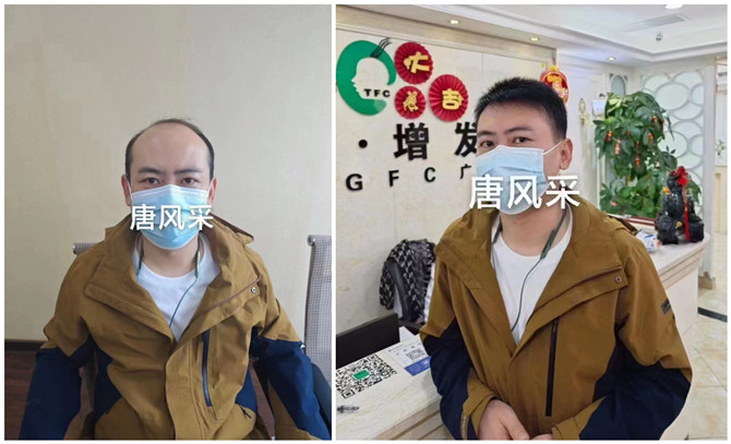 隱形增發(fā) \