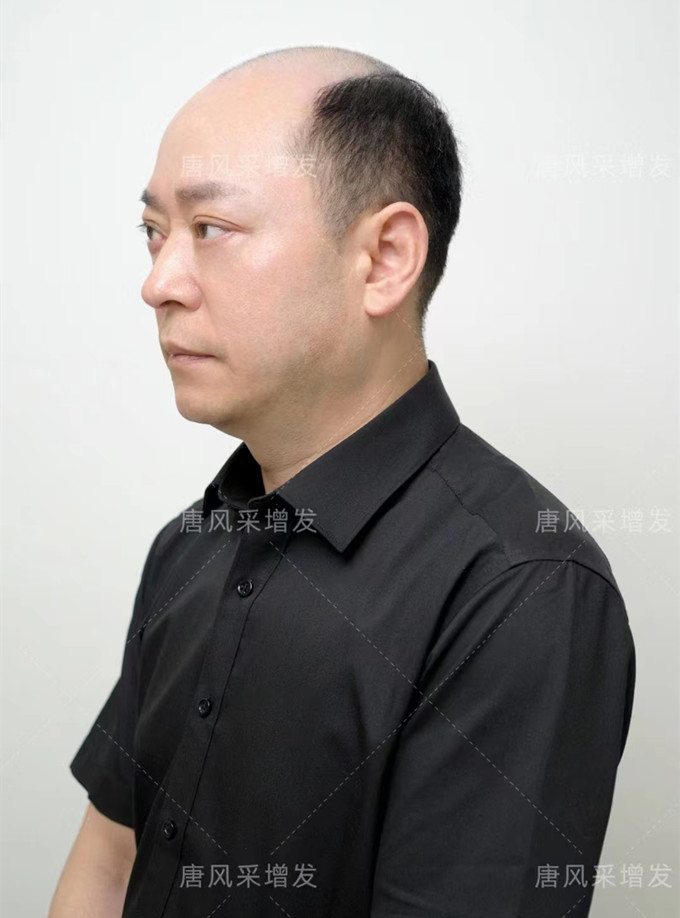 戴假發(fā) \