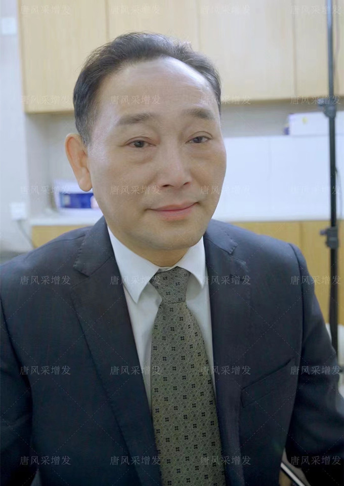 無錫男士假發(fā) \