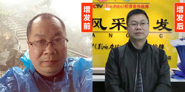 上海假發(fā)專賣(mài)店 上海假發(fā)專賣(mài)店---唐風(fēng)采是發(fā)友們心中的地標(biāo)