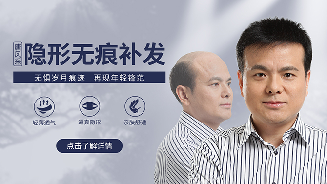 石家莊男士假發(fā)哪家強 \