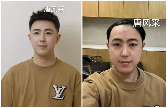 石家莊假發(fā)男士改造 \
