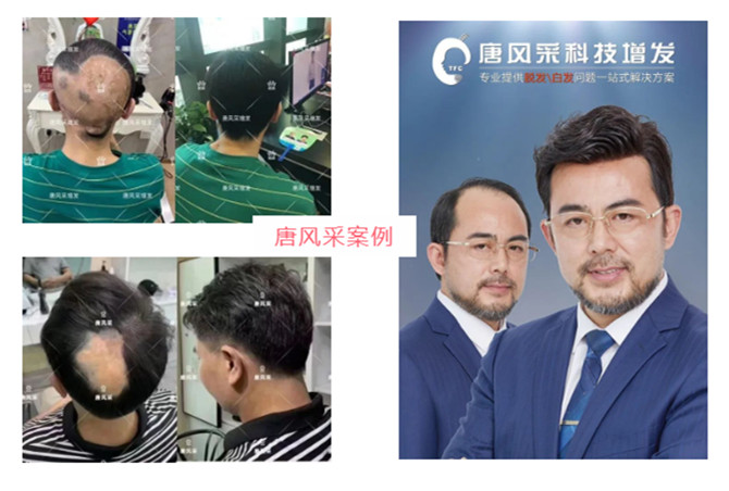 南通假發(fā) \