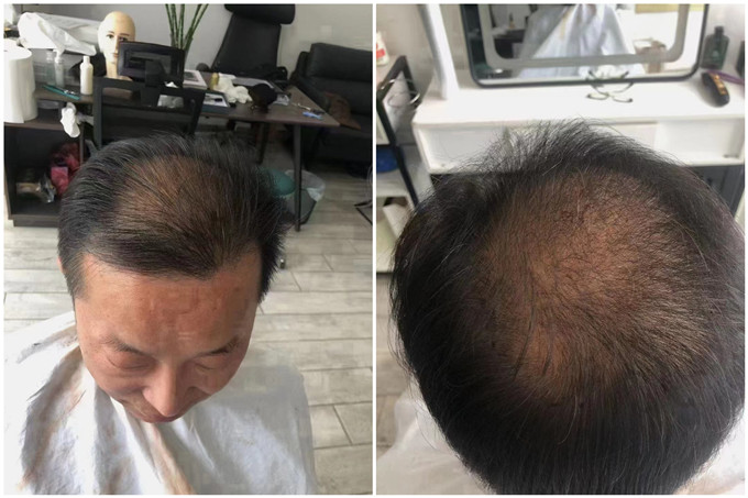 南通假發(fā) \