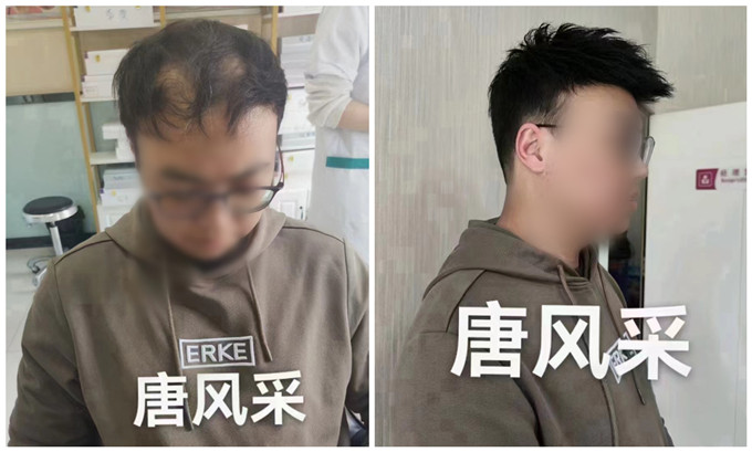 郴州假發(fā)購買 \