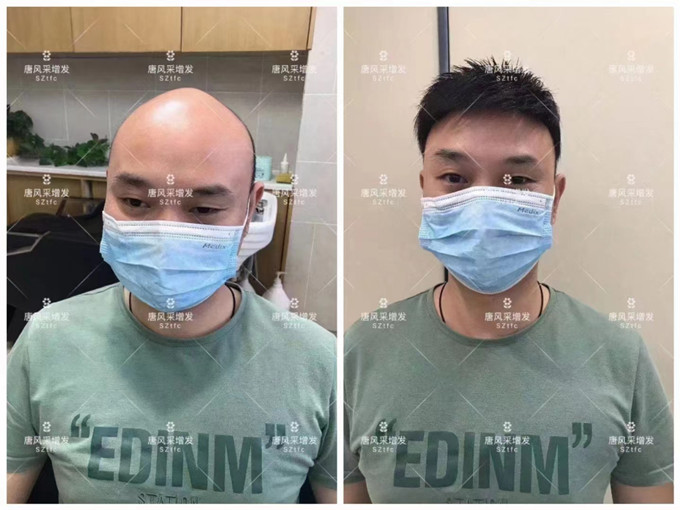 郴州假發(fā)購買 \