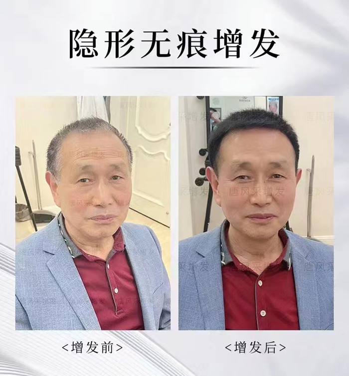東莞中老年選假發(fā) \