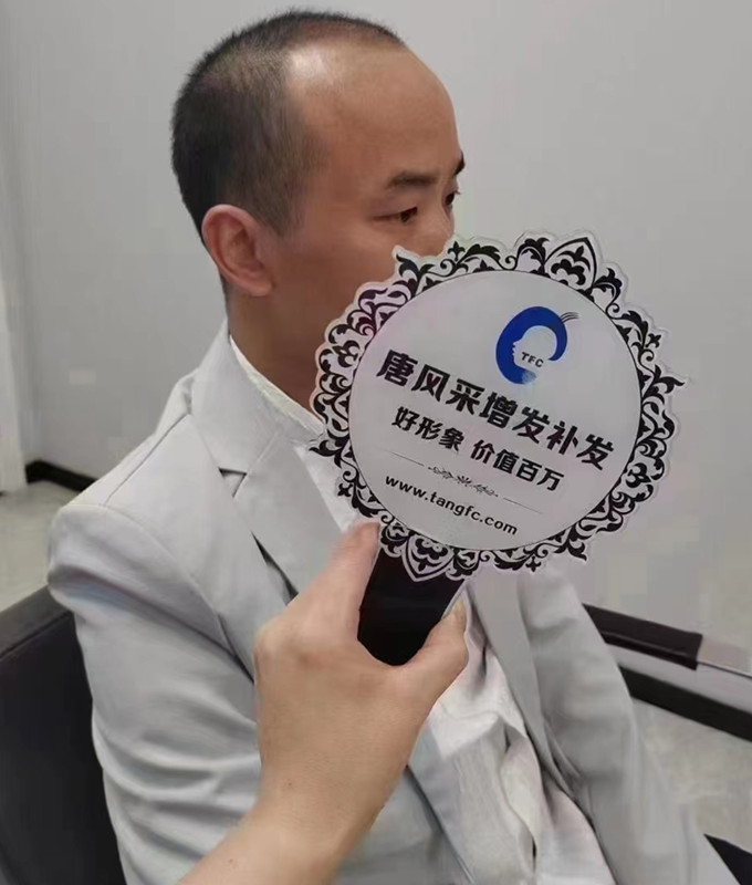 紹興男士假發(fā) \