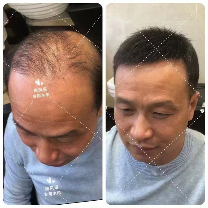 蘇州男士時(shí)尚假發(fā) \