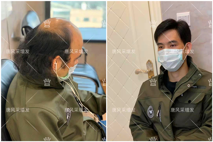 蘇州男士時(shí)尚假發(fā) \