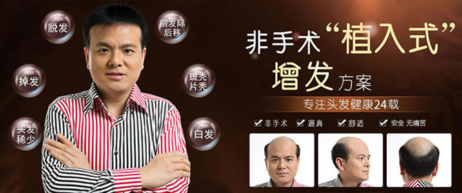 廣州男士假發(fā) \