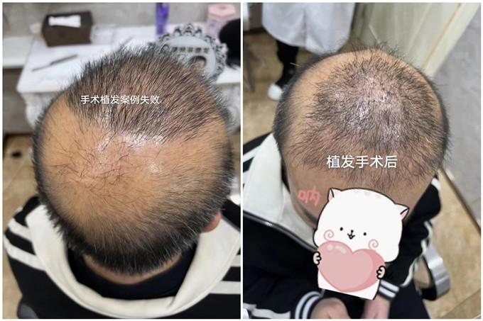 濟南假發(fā)實體店 \