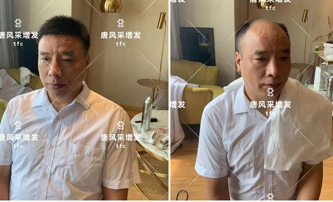 濟南假發(fā)實體店 \