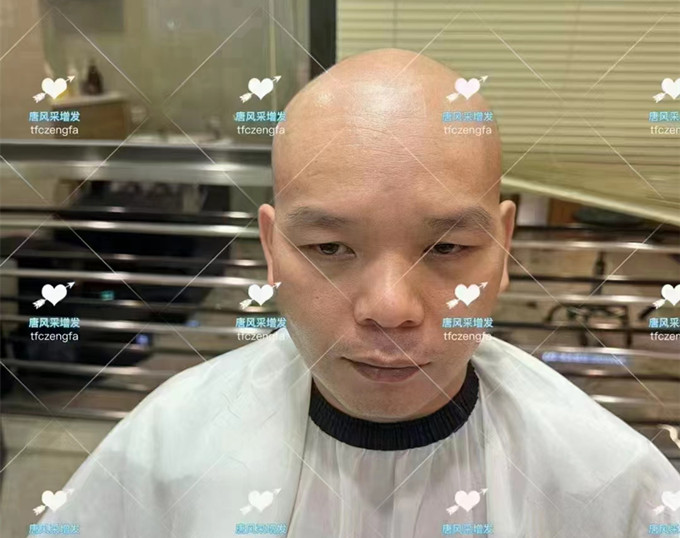 長沙芙蓉區(qū)哪有假發(fā)店 \